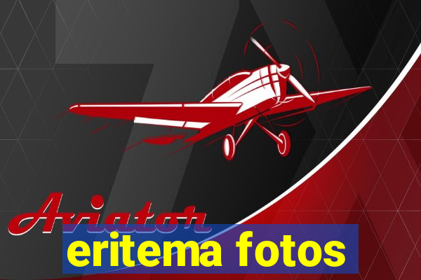 eritema fotos