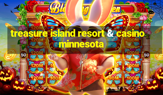 treasure island resort & casino minnesota