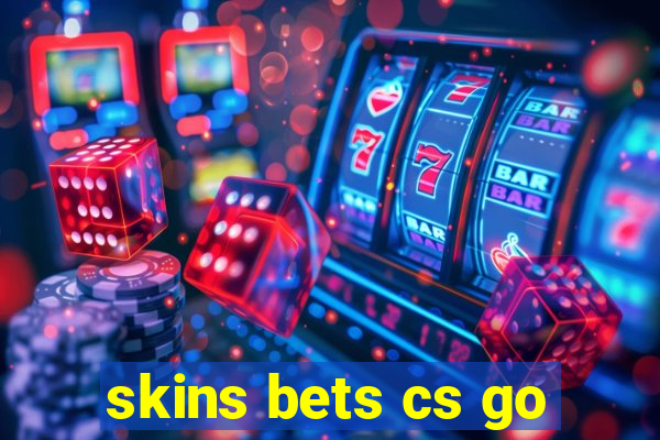 skins bets cs go