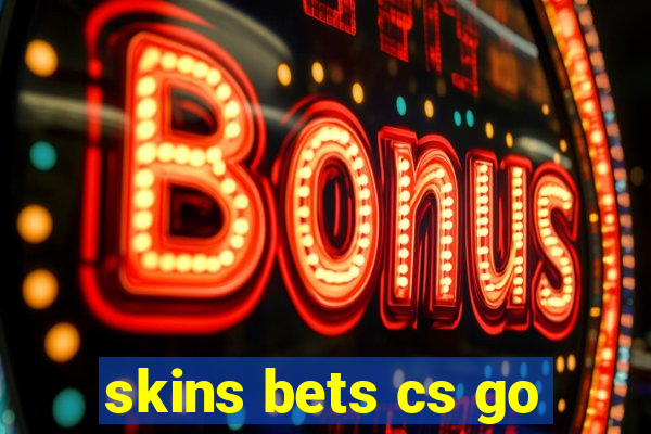 skins bets cs go